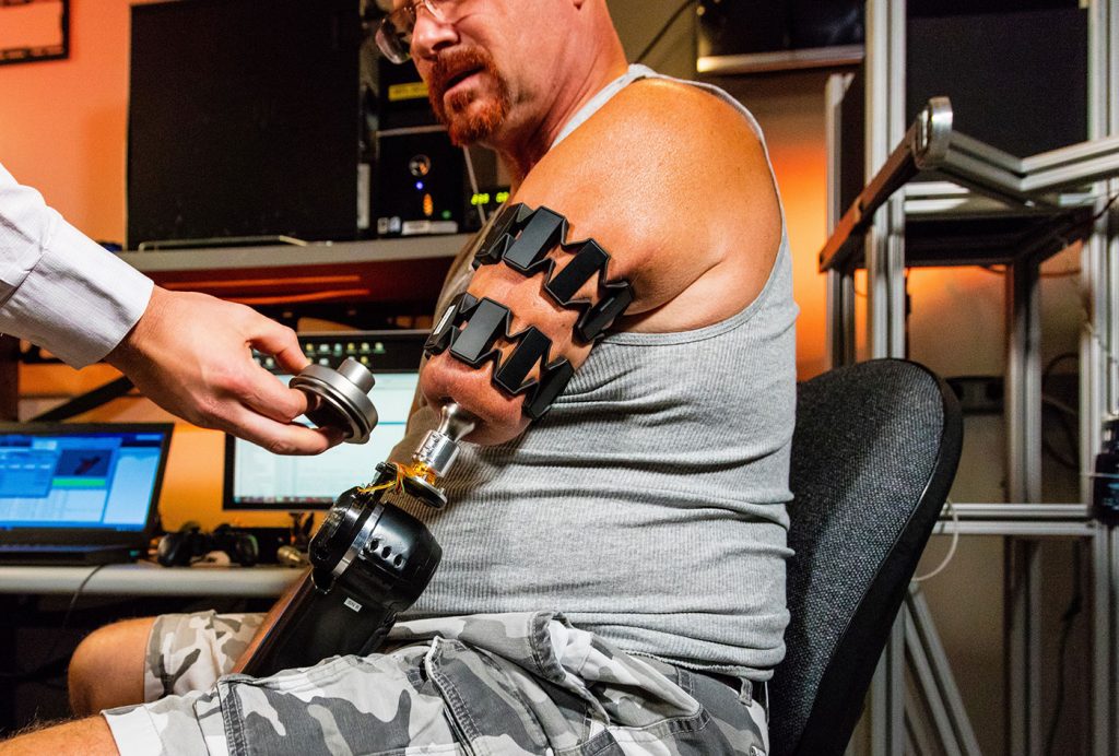 johnny matheny, an amputee, wearing moo armbands and working with his prosthetic arm