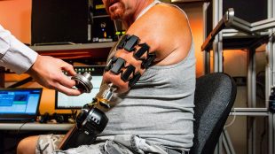 johnny matheny, an amputee, wearing moo armbands and working with his prosthetic arm