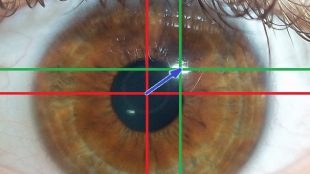 image showing how eye tracking works: Near-infrared light is directed toward the center of the eyes (pupil) causing visible reflections in the cornea (outer-most optical element of the eye), which are tracked by a camera.