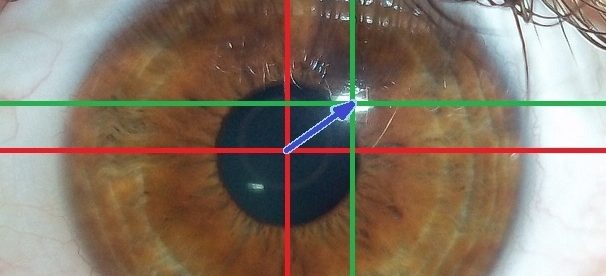 image showing how eye tracking works: Near-infrared light is directed toward the center of the eyes (pupil) causing visible reflections in the cornea (outer-most optical element of the eye), which are tracked by a camera.