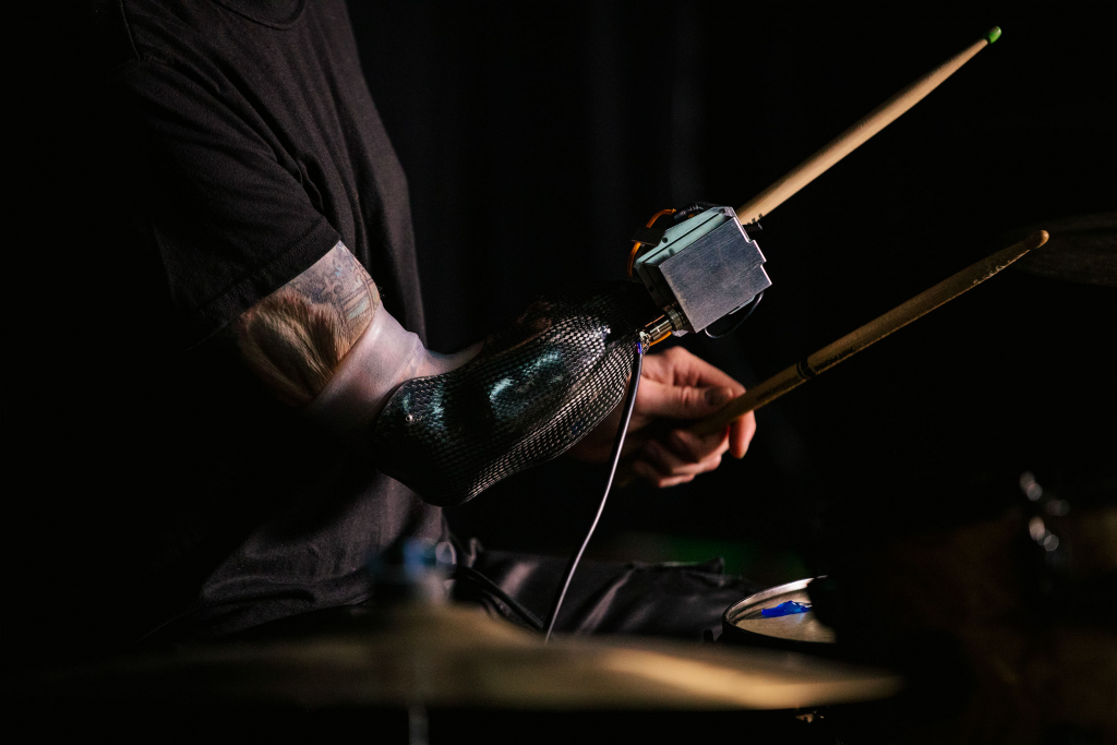 close up of Jason's robotic prosthetic arm he uses for drumming. 