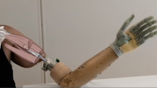 a new bionic hand that allows users with arm amputations to control each finger naturally and effortlessly.