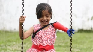 A young girl probably around 5 or 6 years old is on a swing in a park. She is wearing a red floral dress and has a left prosthetic arm that's red and blue.