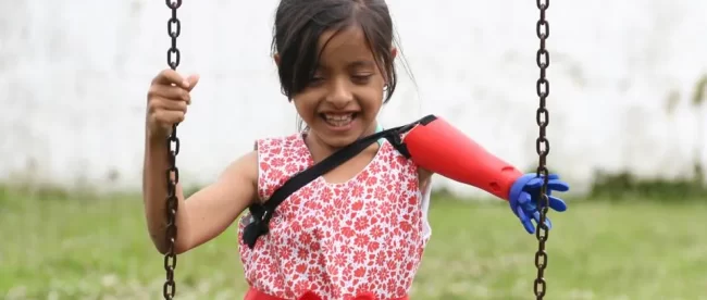 A young girl probably around 5 or 6 years old is on a swing in a park. She is wearing a red floral dress and has a left prosthetic arm that's red and blue.