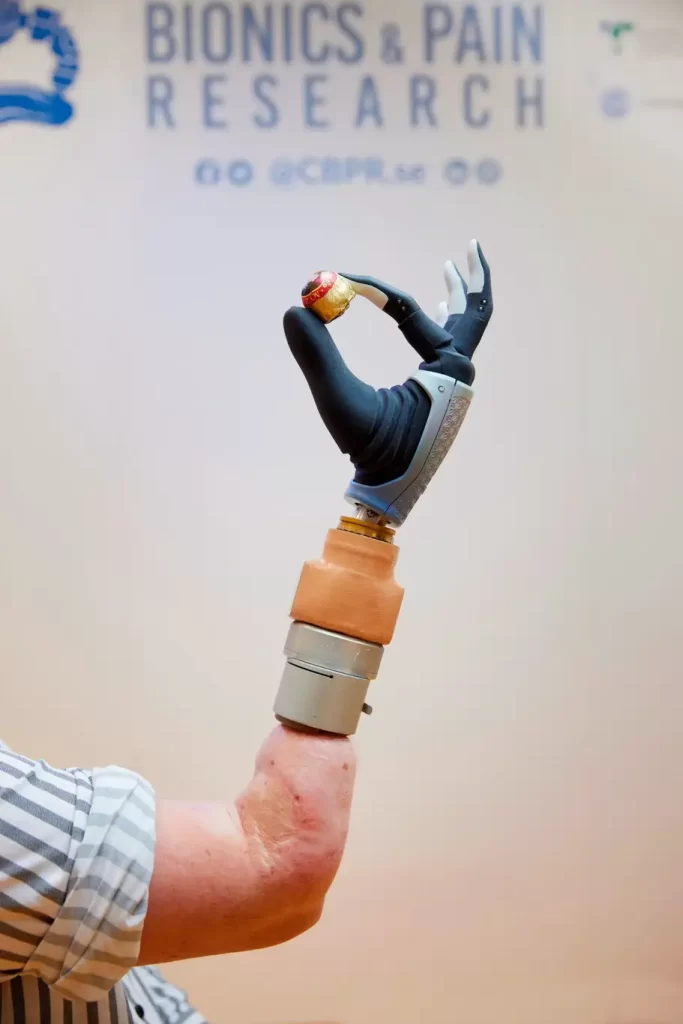 Close up of Karin’s prosthetic hand holding a round chocolate covered in a golden wrapper.