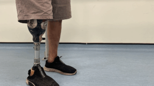 A close-up, low-angle shot of a person standing on a blue floor, showing their right leg which is a prosthetic limb from below the knee. The socket of the prosthetic is decorated black and white